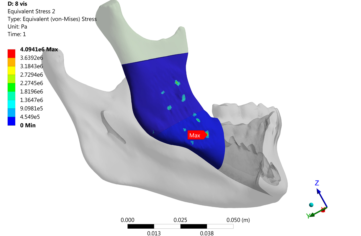 03 simulation numérique-INGPHI