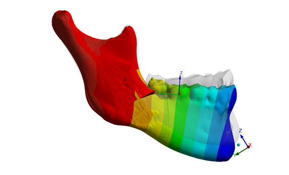 simulation numérique-INGPHI